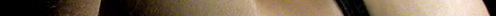epidermis