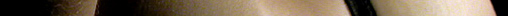 epidermis