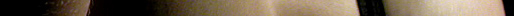 epidermis