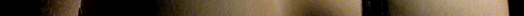 epidermis